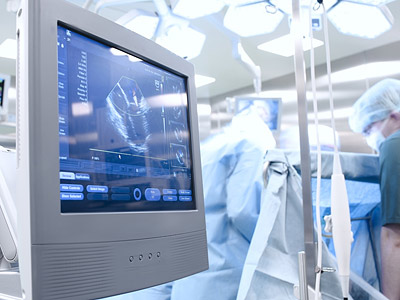 Ein Monitor zeigt ein Ultraschallbild in einem Operationssaal.